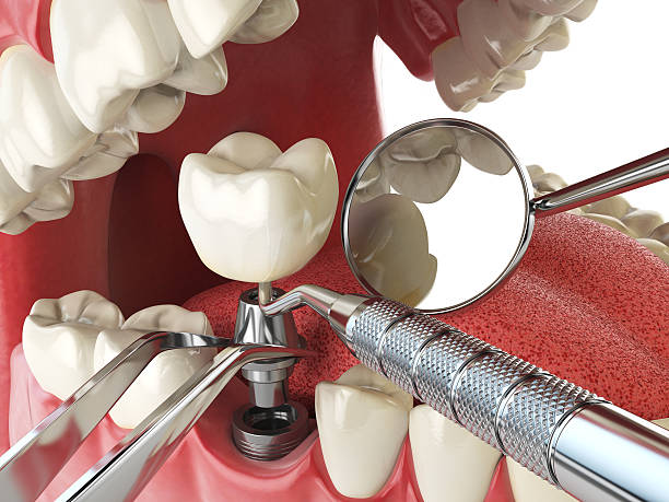 Best Emergency Treatment for Dental Infections or Abscesses in Wooster, AR